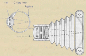 La técnica de la Fijación